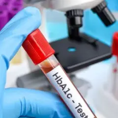 Ile kosztuje badanie hba1c? Sprawdź ceny i ważne informacje
