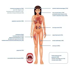 Jakie badania zrobić przy toczniu? Kluczowe testy diagnostyczne