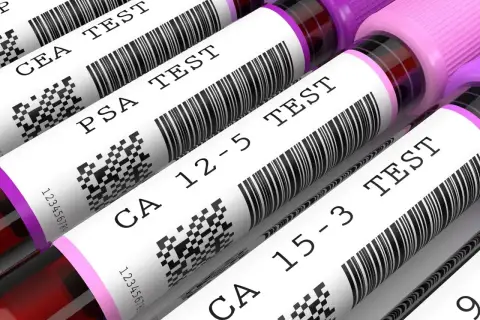 Rurki z próbkami krwi do badań, w tym testu CEA, PSA i CA 12-5.