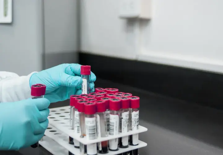 Badanie D-dimerów: co to jest i dlaczego jest tak ważne w diagnostyce?
