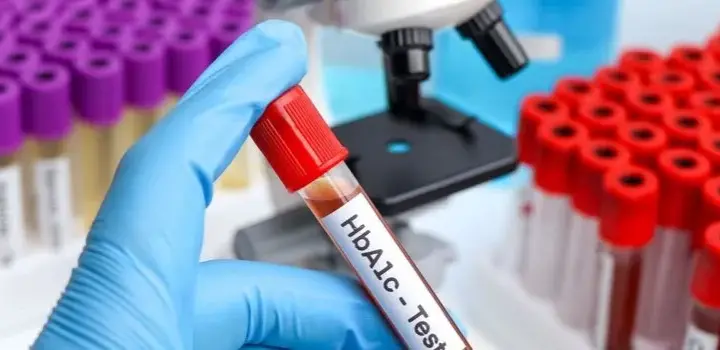 Ile kosztuje badanie hba1c? Sprawdź ceny i ważne informacje