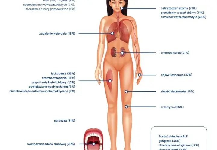 Jakie badania zrobić przy toczniu? Kluczowe testy diagnostyczne