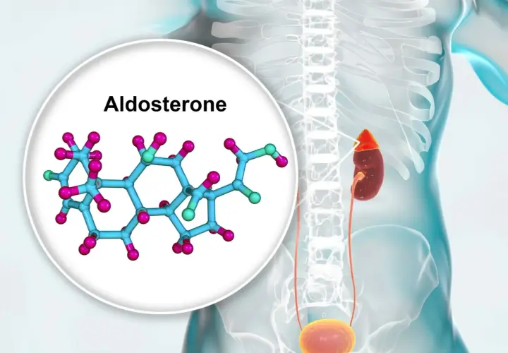 Nadmiar aldosteronu objawy: Jak rozpoznać groźne symptomy?