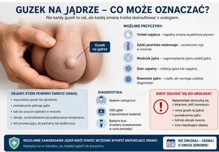 Guzek na jądrze może oznaczać różne rzeczy, w tym nowotwór jądra. Obraz pokazuje guzek na jądrze i wymienia objawy, przyczyny i diagnostykę.