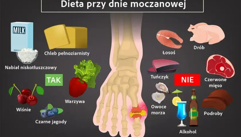 Dieta przy dnie moczanowej: TAK - nabiał, warzywa, owoce. NIE - czerwone mięso, podroby, alkohol. Milurit co to za lek? Zapytaj lekarza.