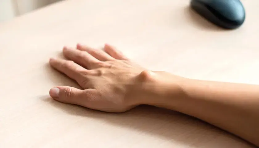 Ganglion do jakiego lekarza? Odpowiedni specjalista na wagę zdrowia