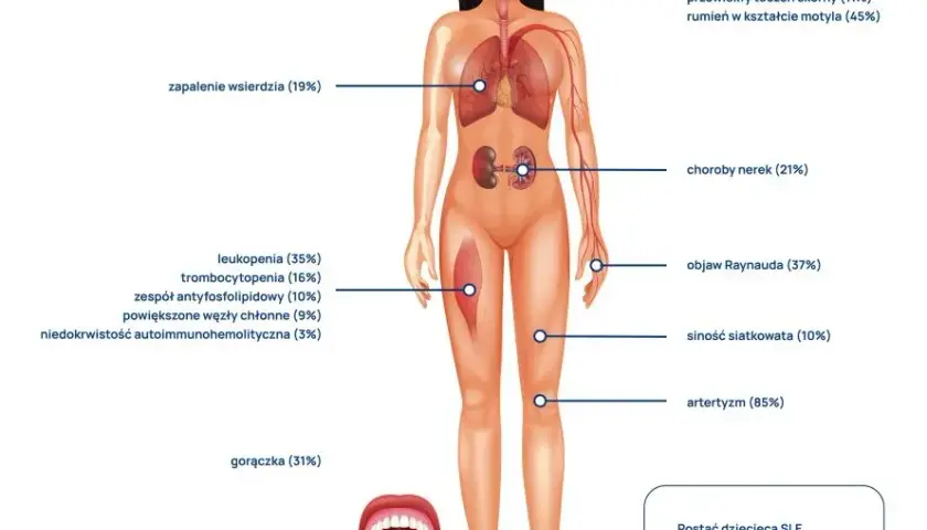 Jakie badania zrobić przy toczniu? Kluczowe testy diagnostyczne