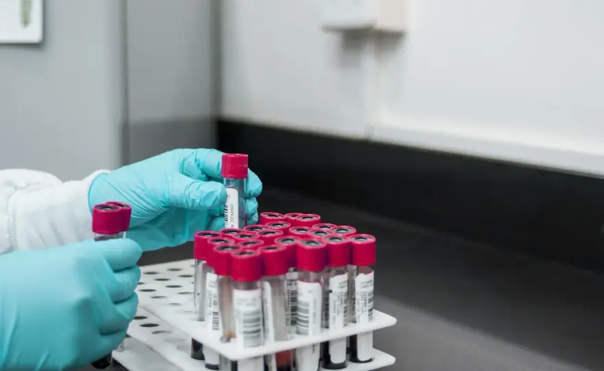 Badanie D-dimerów: co to jest i dlaczego jest tak ważne w diagnostyce?