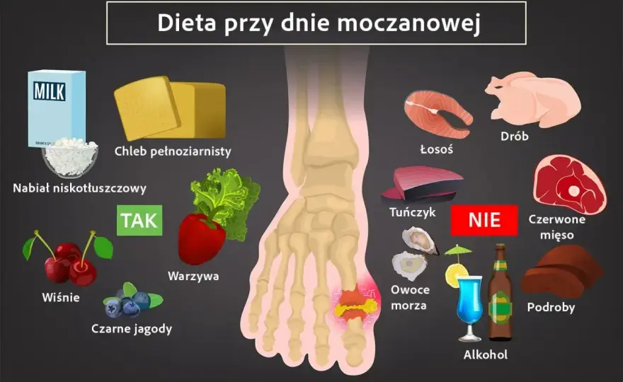 Milurit - jak działa, kiedy się go stosuje i na co uważać?