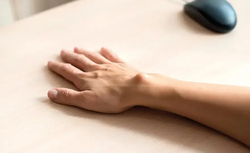 Ganglion do jakiego lekarza? Odpowiedni specjalista na wagę zdrowia