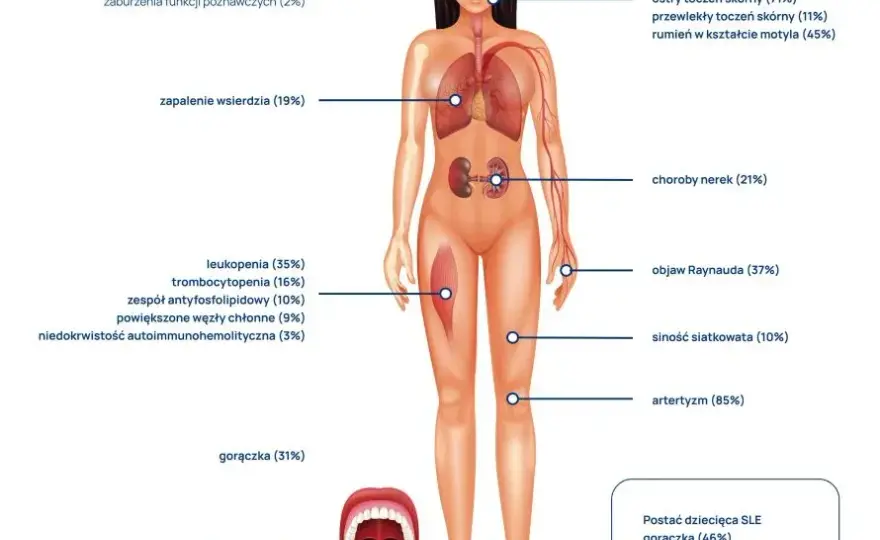 Jakie badania zrobić przy toczniu? Kluczowe testy diagnostyczne