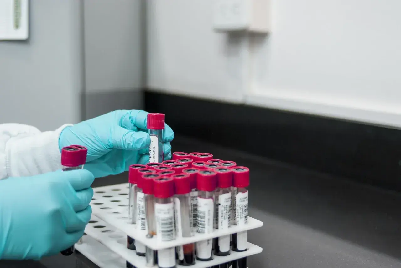 Badanie D-dimerów: co to jest i dlaczego jest tak ważne w diagnostyce?