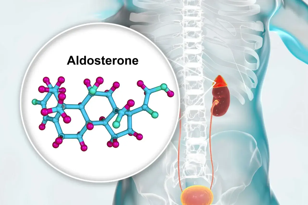 Nadmiar aldosteronu objawy: Jak rozpoznać groźne symptomy?
