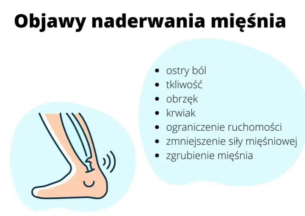 Zdjęcie Naderwany mięsień jaki lekarz - jak uniknąć błędnych wyborów medycznych