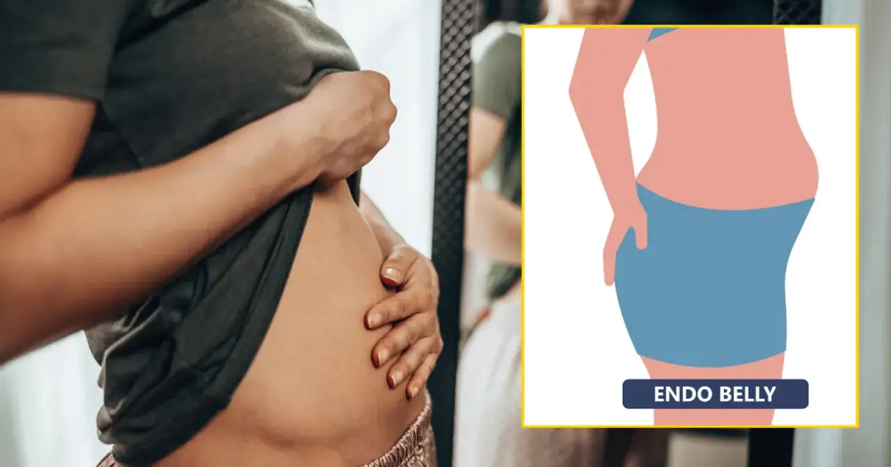 Zdjęcie Endometrioza objawy jelitowe: Jak rozpoznać i uniknąć bólu?